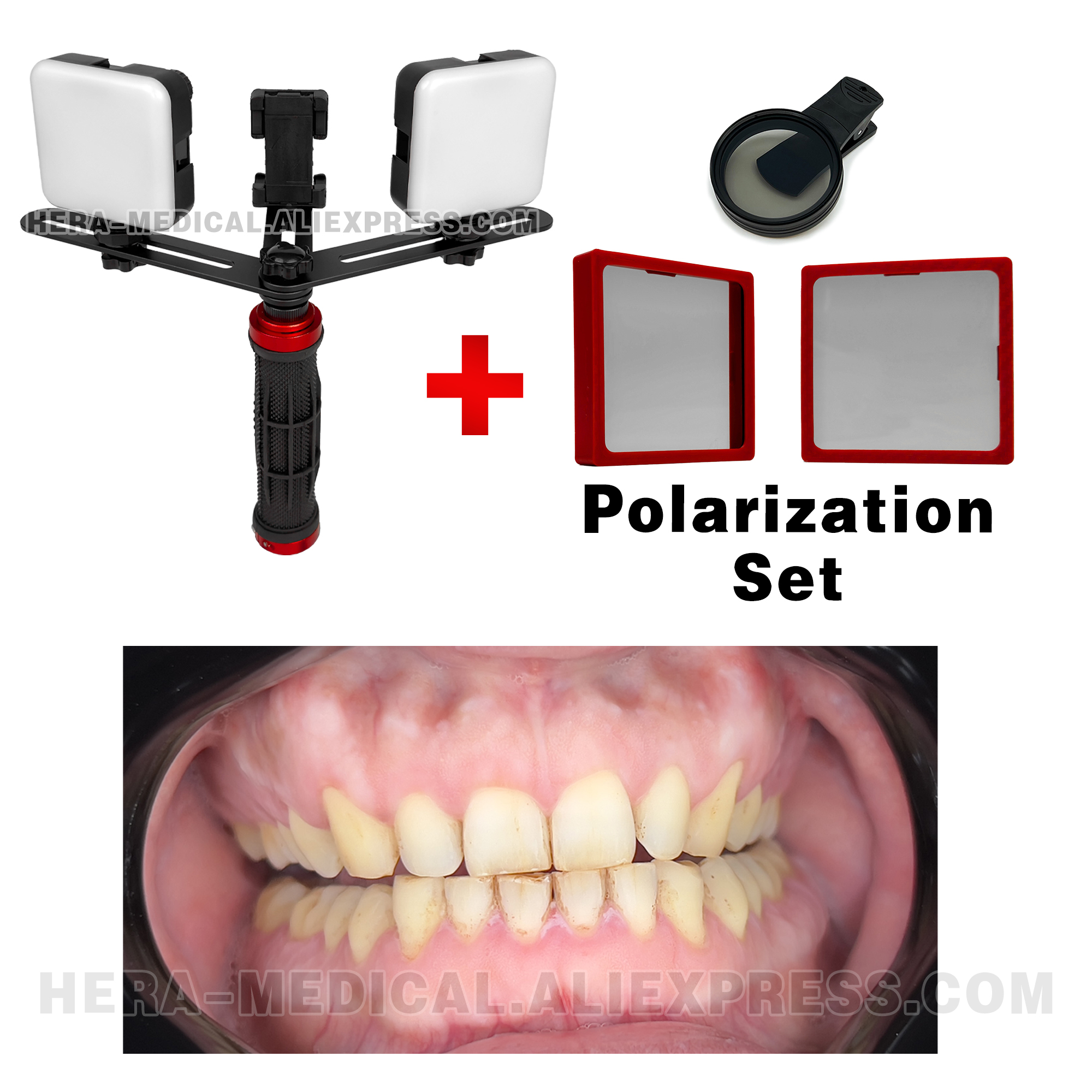 Dental Photography LED Light B - đánh giá và giá Photography Dental