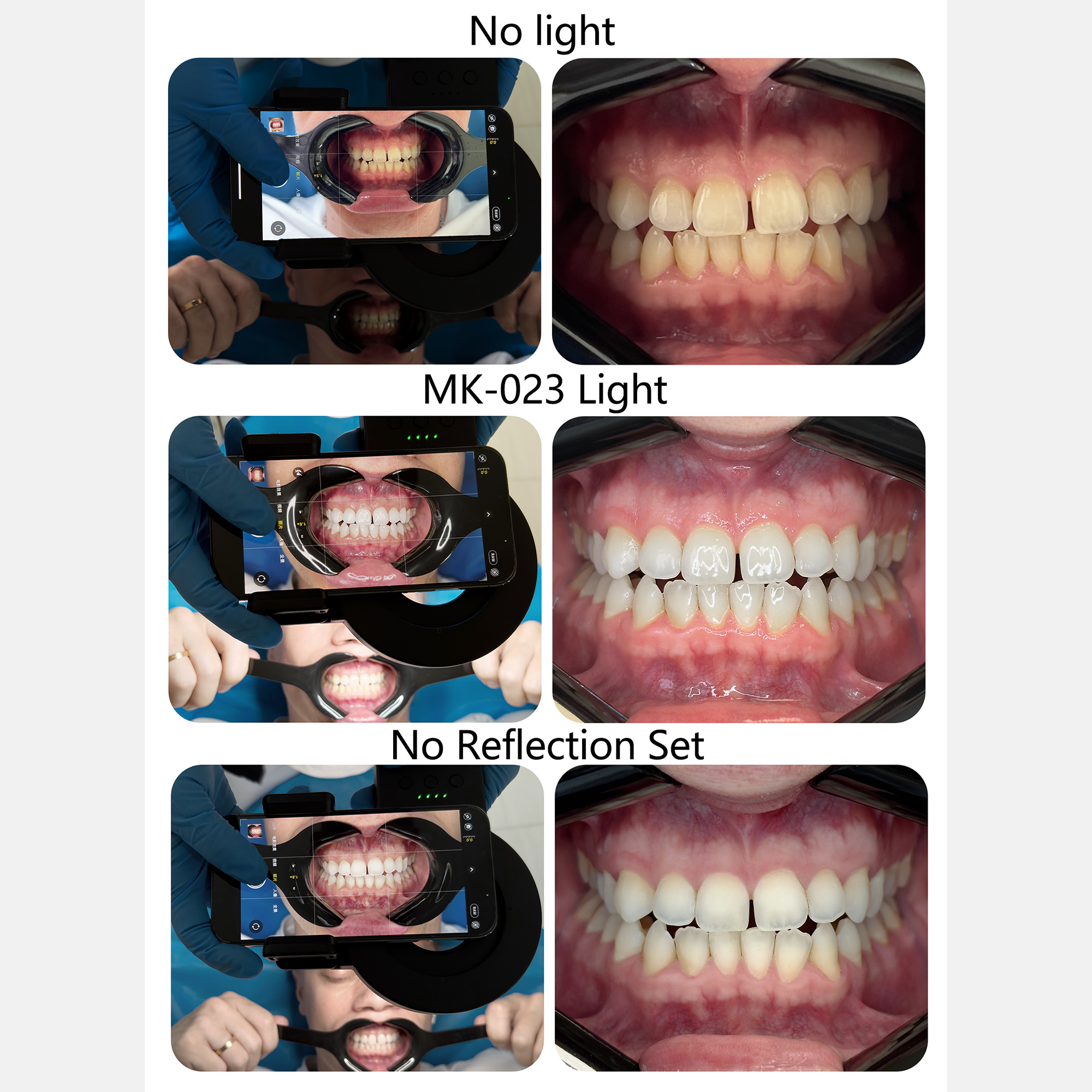 HERA MK-23 Intraoral Dental Ph - đánh giá và giá Photography Dental