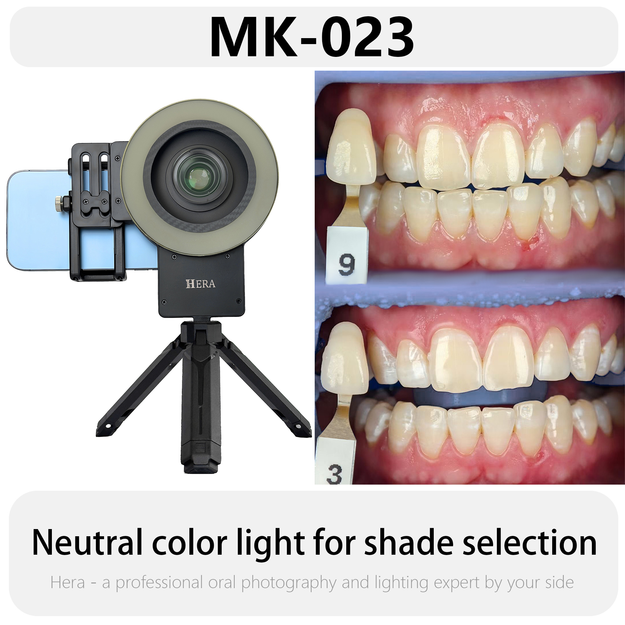 HERA MK-23 Intraoral Dental Ph - đánh giá và giá Photography Dental