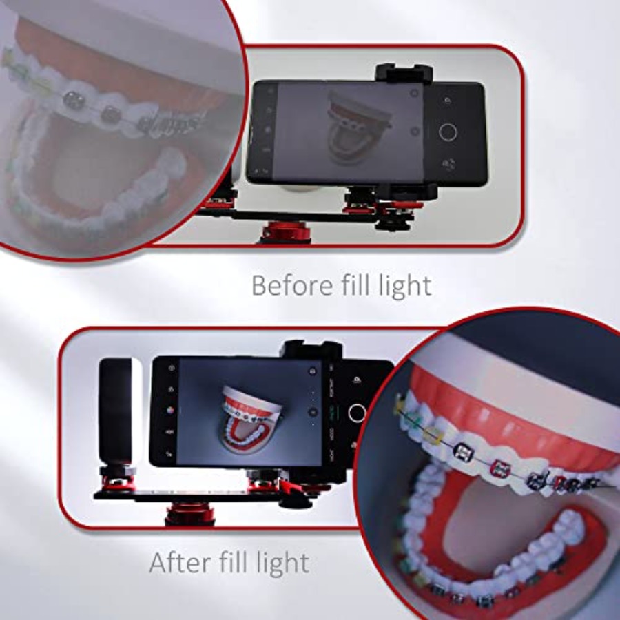 Bluetooth Dental Flash Light P - đánh giá và giá Photography Dental