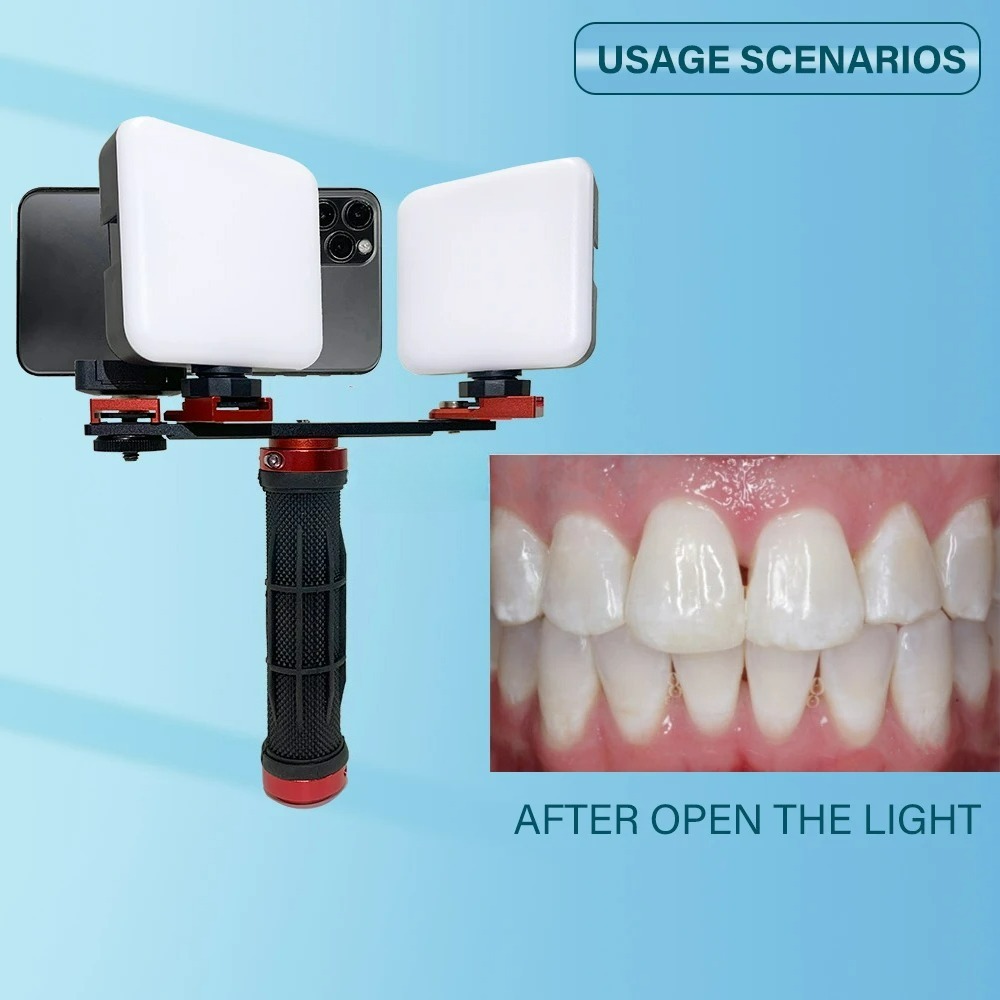 Dental Photography Light Phone - đánh giá và giá Photography Dental