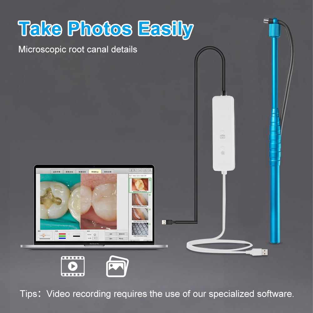 5MP Micro Intraoral Camera Den - đánh giá và giá Photography Dental