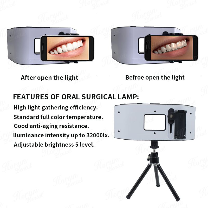 Dental Flash Light Photography - đánh giá và giá Photography Dental